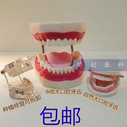 口腔保健护理牙齿模型 幼儿园教具 儿童刷牙玩