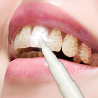 牙齿美白笔速效去除黄牙垢牙斑烟渍氟斑牙四环