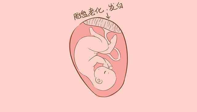 69 首页 69 文章总览 69 查看内容  胎盘是母体给胎儿供应氧气