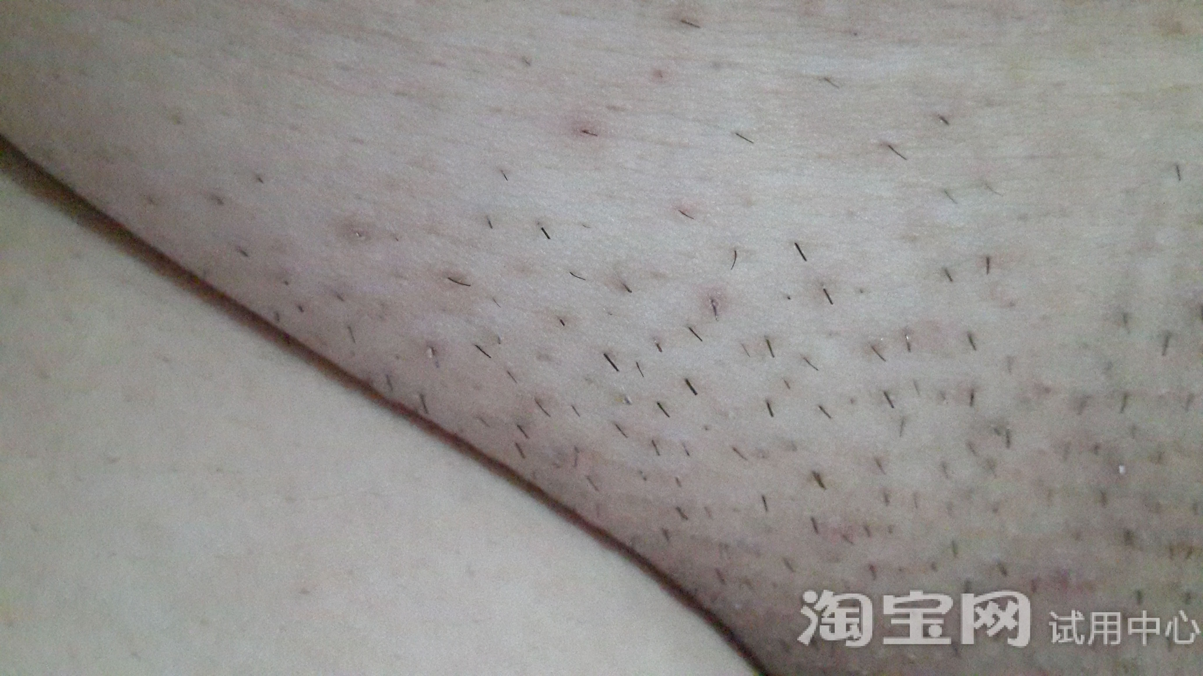 比基尼修剪效果对比