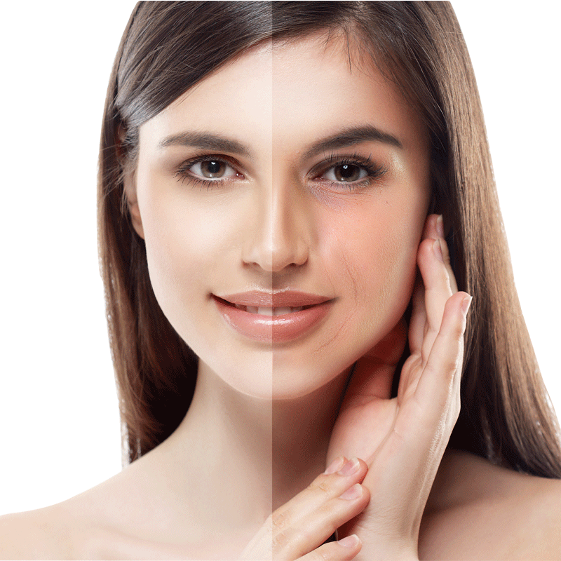 美莱医疗美容整形旗舰店官网 进口除皱 祛鱼尾/抬头/眉间面部抗衰