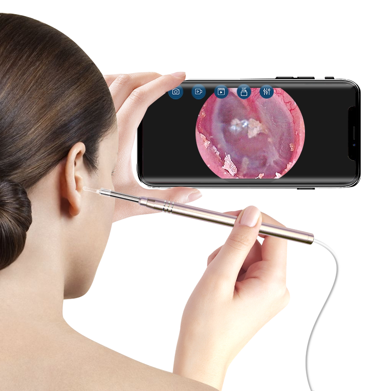 掏耳神器高清可视挖耳勺掏耳朵工具套装内窥镜耳镜耳内镜扣耳屎