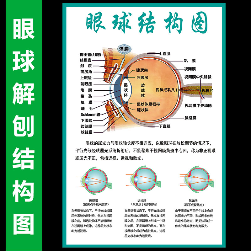 眼睛眼球结构图眼球解剖图剖面图眼科海报挂图展板墙贴宣传画图片