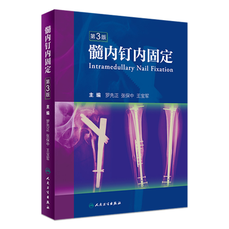 髓内钉内固定（第3版） 2023年
