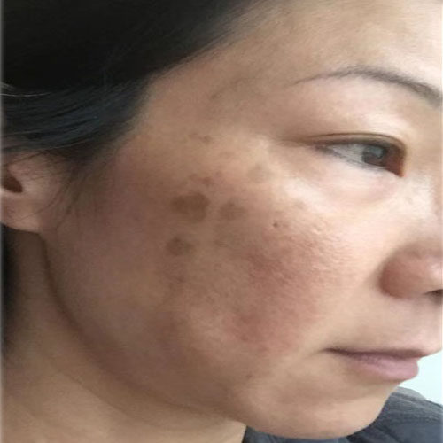 去除脸上一切斑点黑点 洁面不留痕 黑色素净颜美肤祛斑霜男女通用