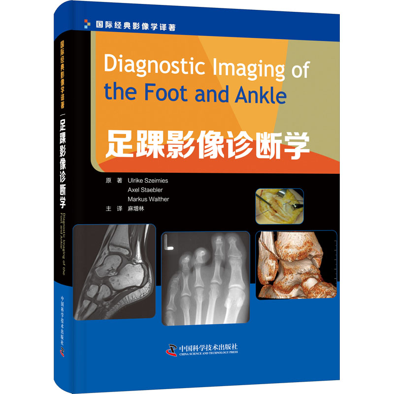 足踝影像诊断学 (德)乌尔丽克·斯蔡密斯,(德)阿克塞尔·斯戴布勒,(德)马库斯·瓦尔特 著 麻增林 译 影像学|ruв категории книги/журнал/газета, медицинского здравоохранения, медицины других - от Buy2taobao.com для оказания профессиональной услуги покупки агента Taobao