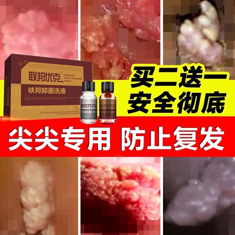 鬼臼软膏毒素酊正品竹足叶草脂咪喹莫尖锐男乳膏重组人干扰素a2ab