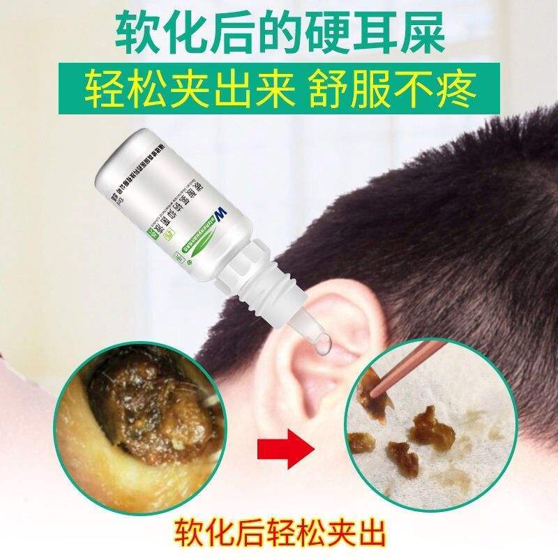 耵聍水滴耳液