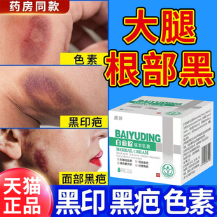 大腿内侧去黑色素根部黑不黑了祛痘印疤除黑色素沉着药膏屁股沉淀