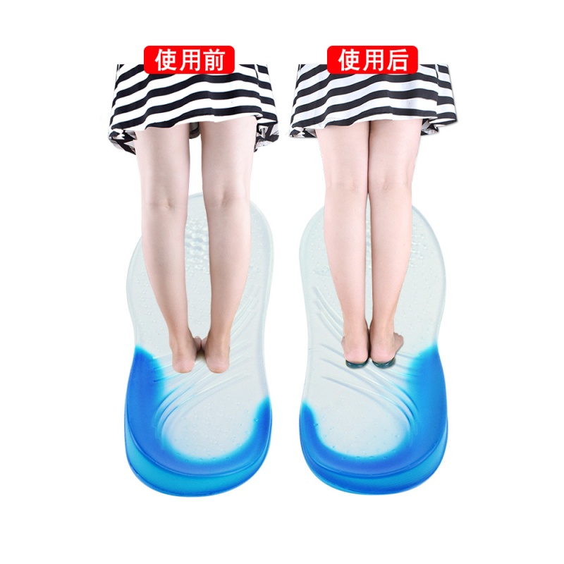 o型腿矫正鞋f垫女式七分垫足内翻罗圈腿x型腿足外翻矫正楔形鞋垫|msdalam kategori Aksesori/Belt kulit/Hat/Muffler, Kasut dan beg/Aksesori tali pinggang, Kasut aksesori, maka tapak dalam - dari Buy2taobao.com untuk memberikan perkhidmatan ejen Taobao profesional membeli