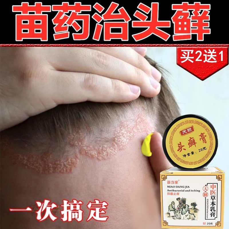 头皮藓药头部头皮癣专用药膏真菌感染洗发水治牛皮藓苗家偏方药膏