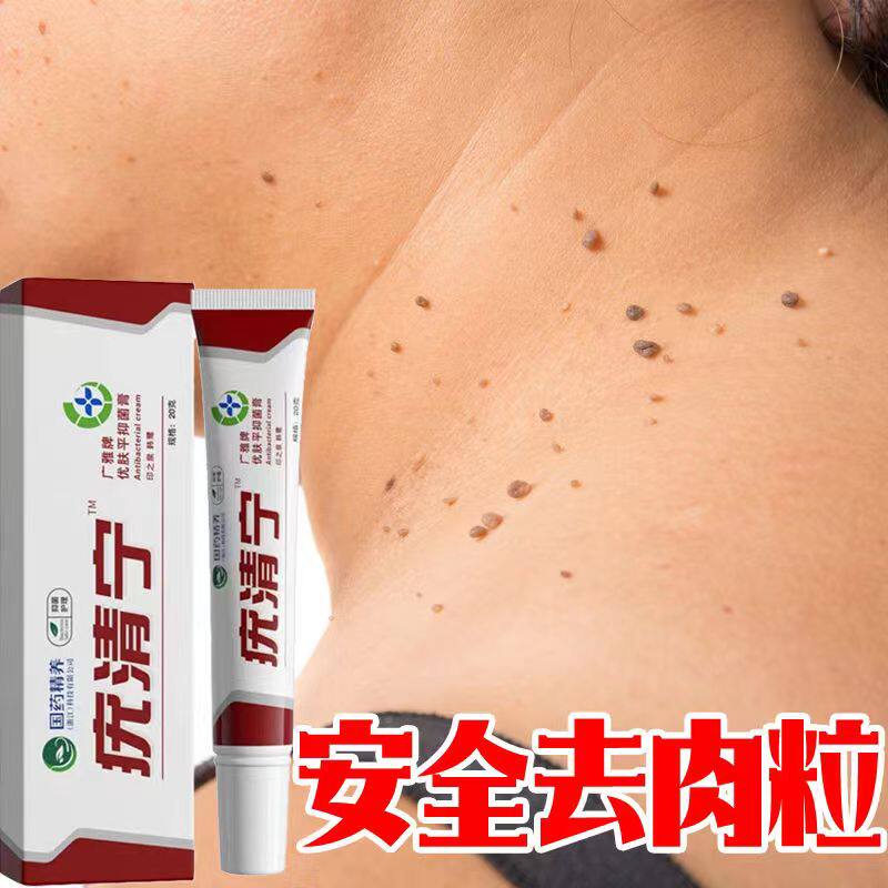 草本克疣液丝状疣脖子颈部去除肉粒疙瘩祛瘊子扁平尤克优膏疣瘊净
