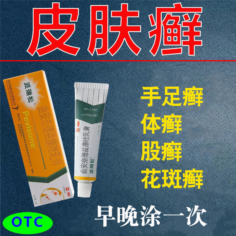 派瑞松药膏软膏曲安奈德益康唑乳膏皮炎体癣皮肤癣手足癣病药膏zm