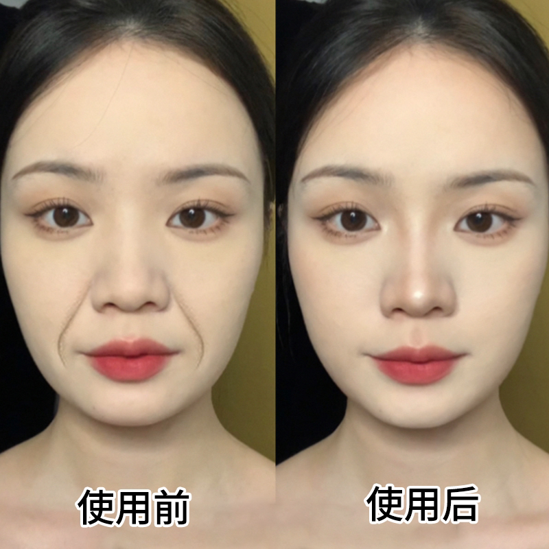 法令纹贴拉紧官方旗舰店正品面膜消除淡化告别神器贴片面膜