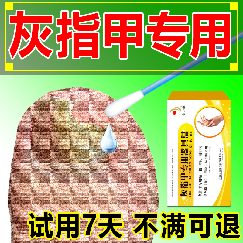 冰醋酸涂剂灰指甲