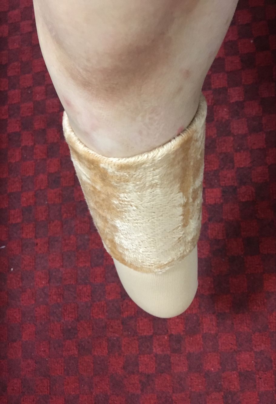 正品超级加厚加绒小腿残肢袜套 假肢袜套 残疾人义肢袜套截肢袜子