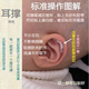 婴儿耳廓矫形器耳撑纠正矫正器固定牵引器小孩防压定位贴校正垂耳