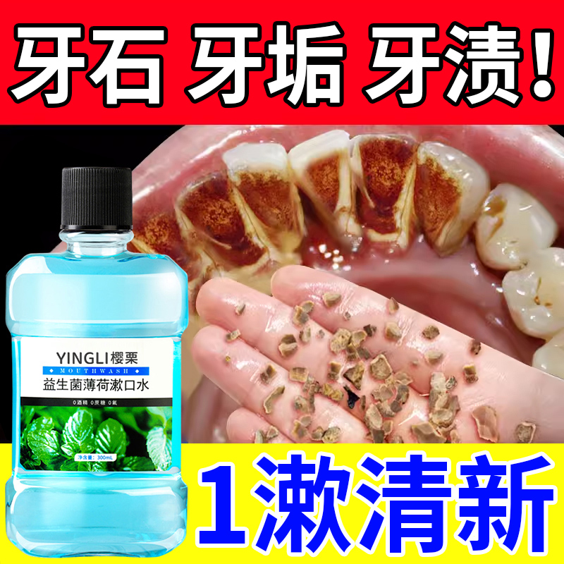 益生菌漱口水杀除口菌臭持久留香消遬