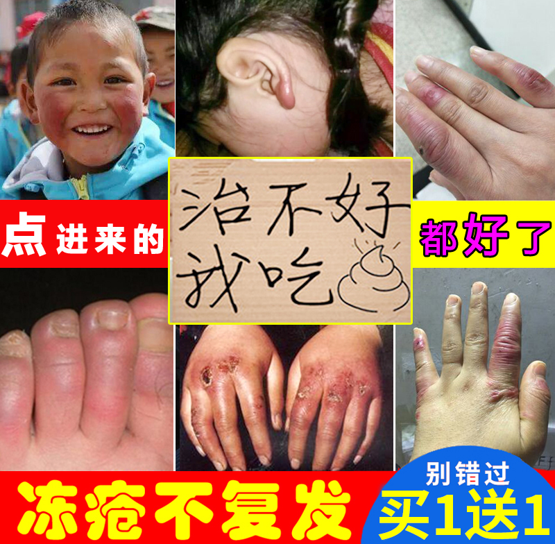 热销马油防冻防裂霜_冻疮膏蛇油马油消肿止痒治根冻伤膏儿童冻手足