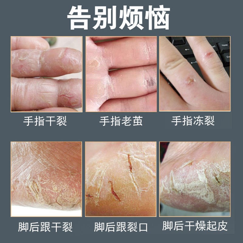 仁和匠心皲裂膏