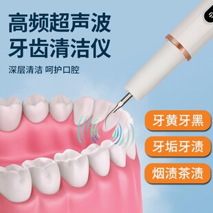 月儿弯弯美智橙超声波洁牙神器去烟渍去黄家用洗牙器去牙垢美牙仪