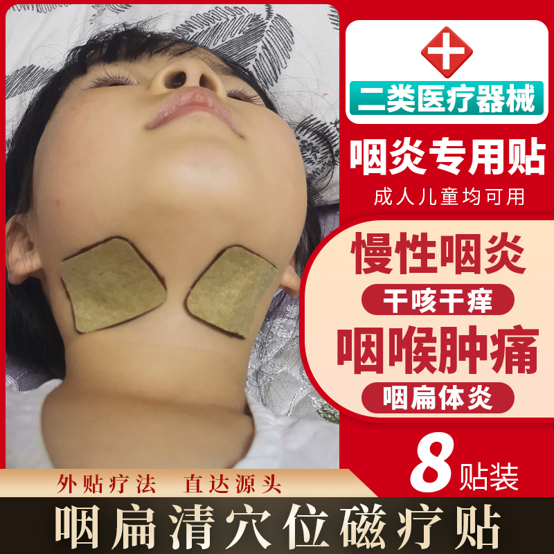儿童咽扁贴扁桃体贴发炎咽炎化脓贴冷敷扁桃体肥大肿大腺样体肥大