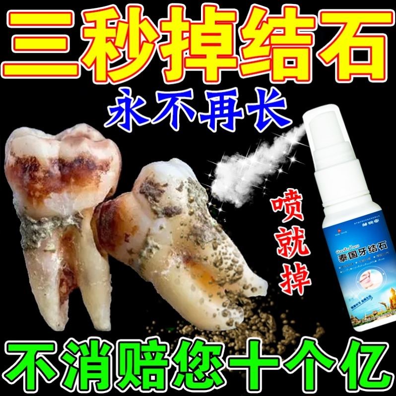 去除牙结石软化剂速效溶解牙石去牙渍牙垢黄牙神器杀菌除口臭专用