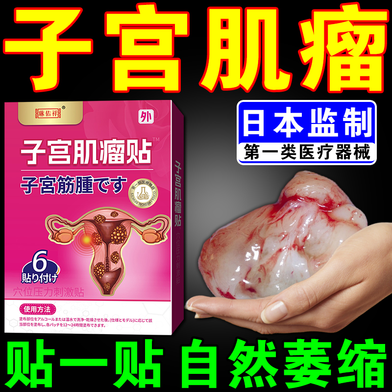 子宫肌瘤中药贴治疗卵巢囊肿的瘤清泡脚包热敷自己调理巧克力囊肿