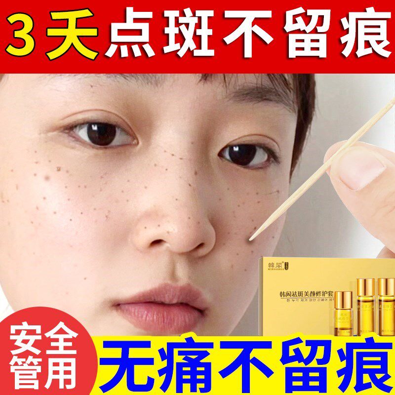 点斑水无痕正品水祛遗传雀斑美容院精华液祛斑金水黑痣非专用药水