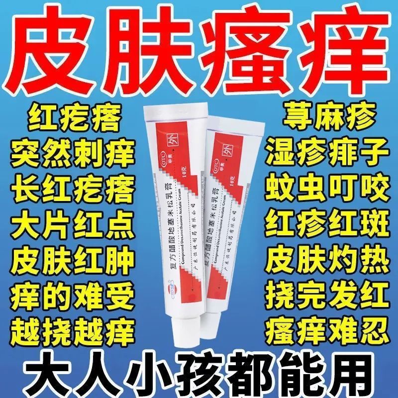 复方醋酸地塞米乳膏皮肤瘙痒止痒外用的特效药膏止痒抑菌去xf根