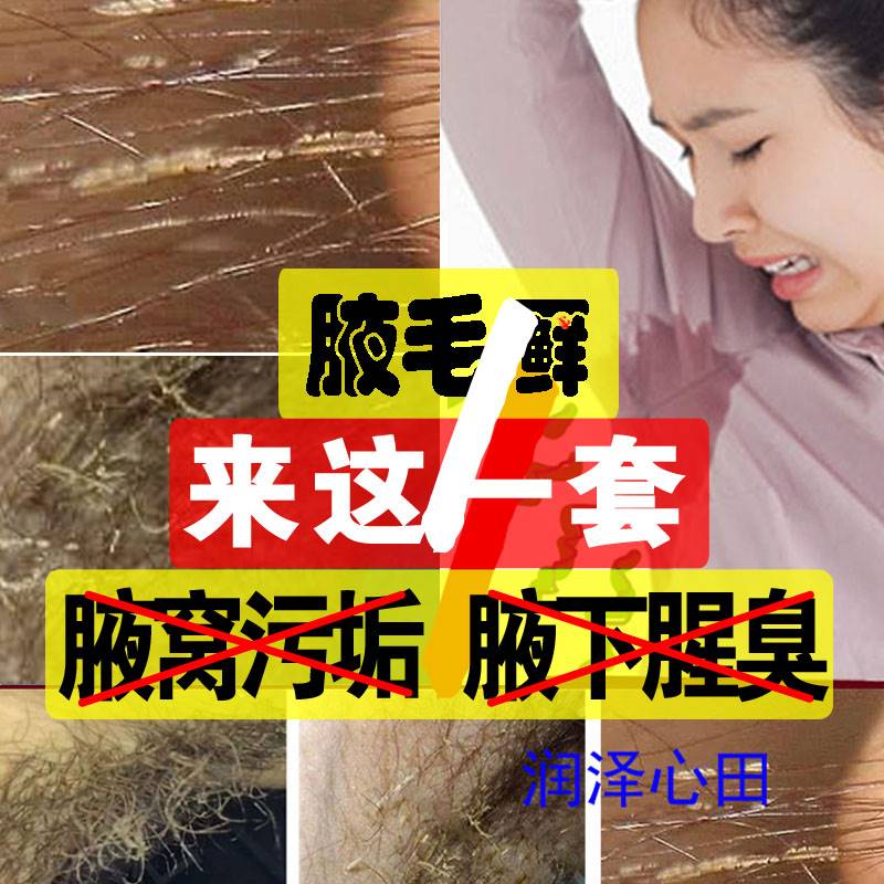 00腋毛癣清洗液喷剂去男性毛干黄白色结节颗粒除腋窝污垢异味藓药膏