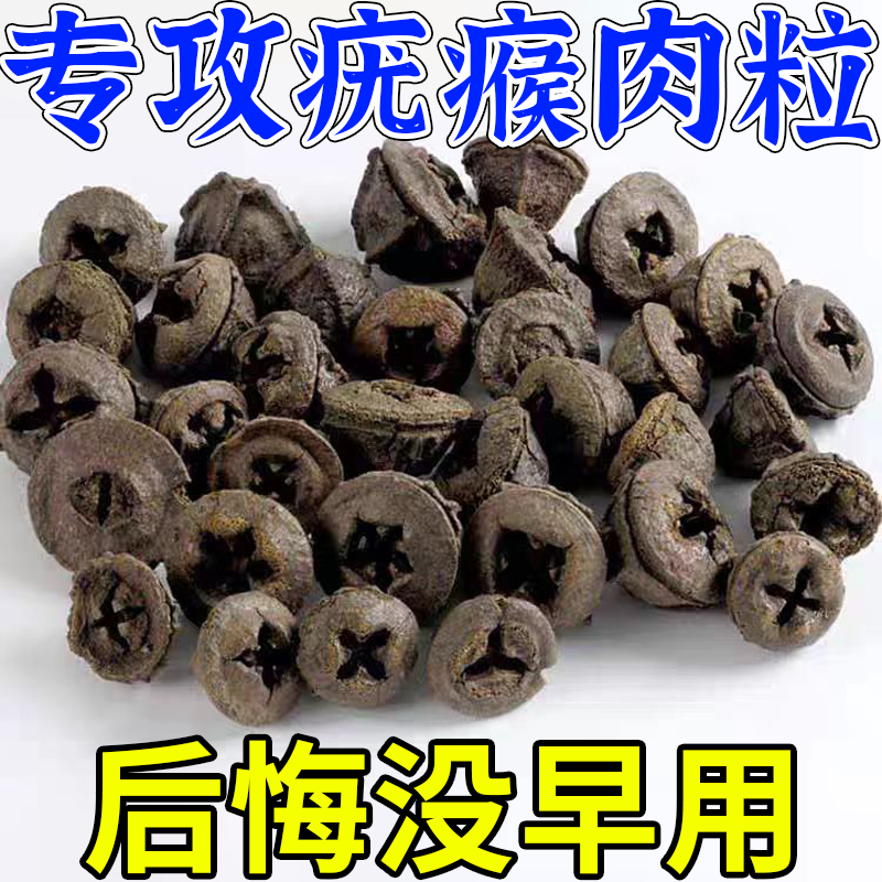 激光点痣点扁平疣仪器去祛疣瘊肉粒扁平疣丝状疣跖疣无痛脱落药膏