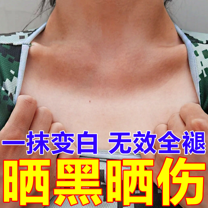 晒黑了皮肤晒伤儿童军训晒后修复霜快速变白身体乳脸脖子美白专用