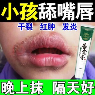 云南本草儿童嘴唇口唇炎专用药唇炎润唇膏嘴唇干裂脱皮修复药用护