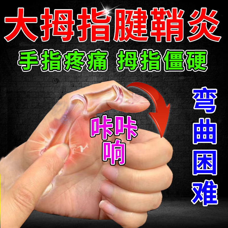 专治大拇指腱鞘炎的药腱鞘炎手指关节疼痛专用膏药贴健鞘炎专用