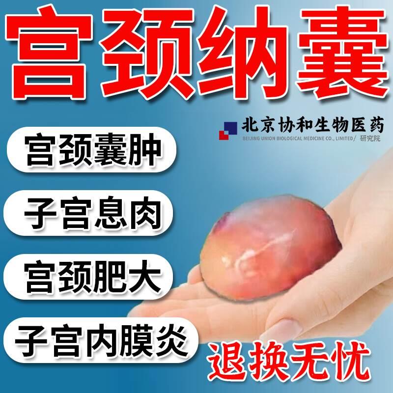 宫颈纳氏囊肿治疗宫颈纳囊的子宫内膜息肉中薬贴宫瘤清肌瘤卵巢DZ