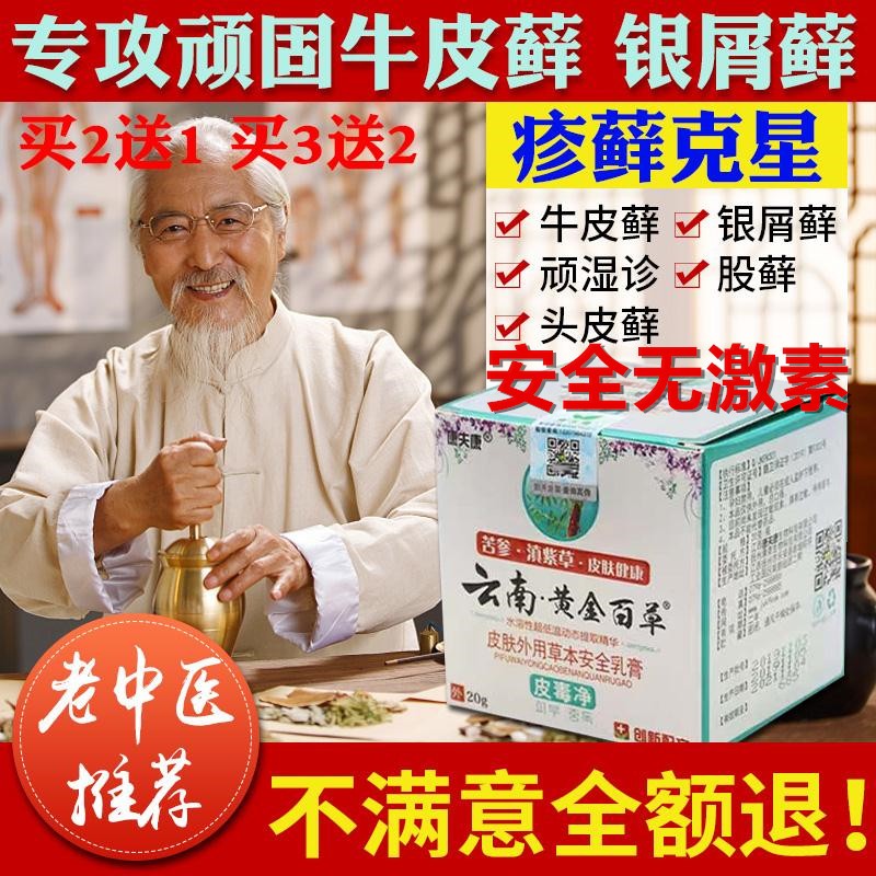 手癣手足藓真菌感染汗疱疹手脚脱皮干裂水泡手脚癣止痒鹅掌风药膏