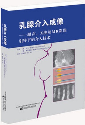 正版 乳腺介入成像——超声、X线及MR影像引导下的介入技术 9787538182033 辽宁科技 （德）乌韦.费舍尔 影像技术 书籍