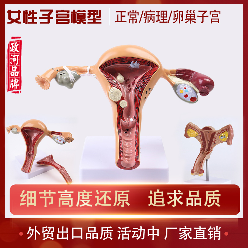 人体模型女性生h殖病理子宫阴道卵巢医用教学模具病理变化培训器