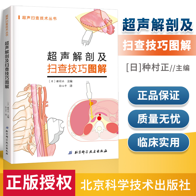 正版超声解剖及扫查技巧图解 介绍设