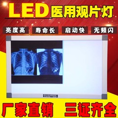 包邮x光胶片观片灯led观片灯箱单联双联三联铝合金阅片灯看片灯箱