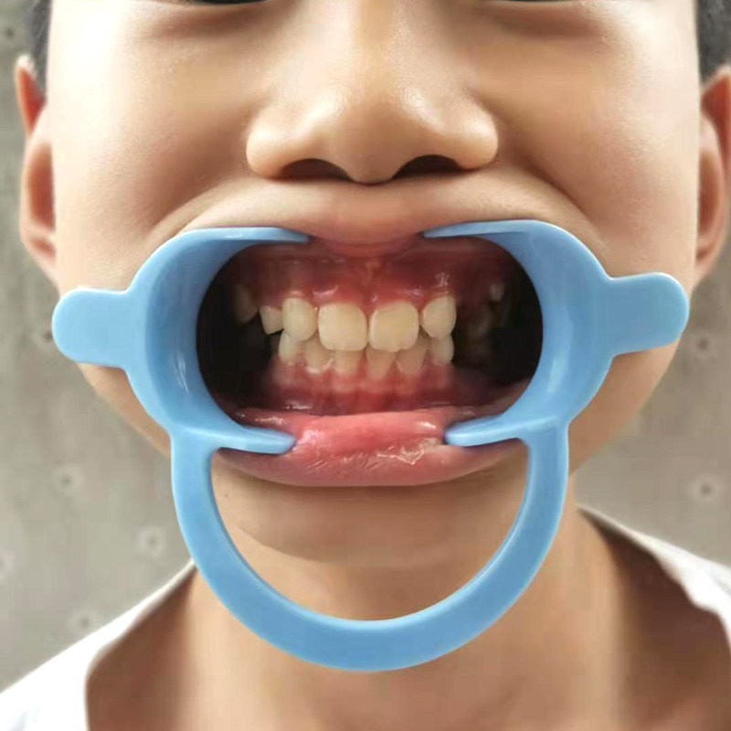 纳米釉质c型开口器c型扩口器带翼口撑牙齿美白冷光美白用扩口器