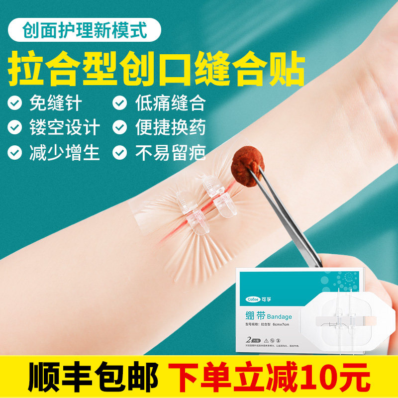 可孚医用拉合式免缝针弹性绷带医疗伤口创口贴包扎拉链式术后缝合