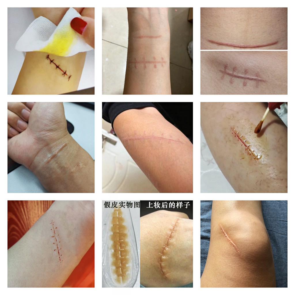 伤疤贴仿真
