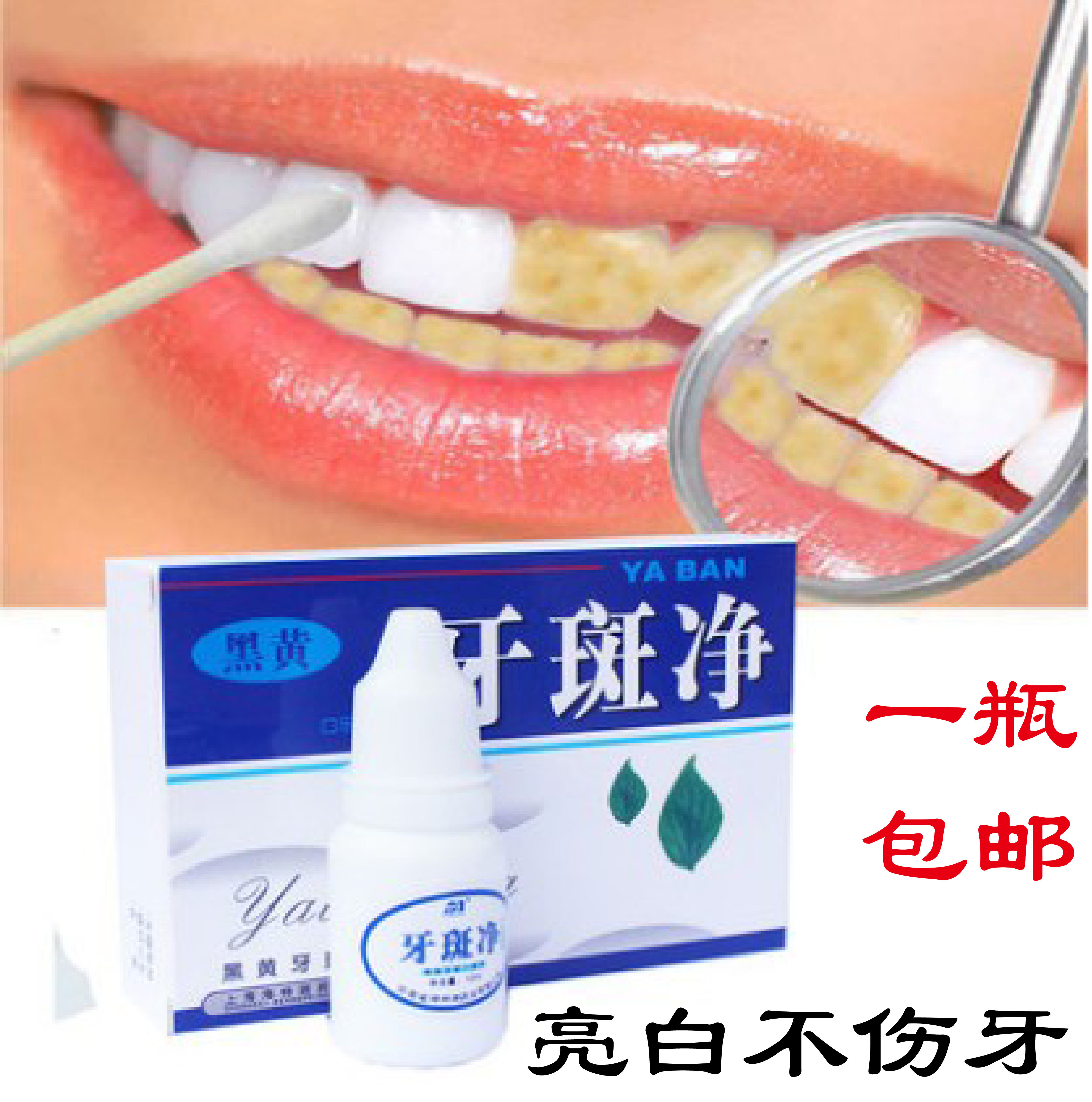 牙斑净牙齿美白去烟渍 黑黄