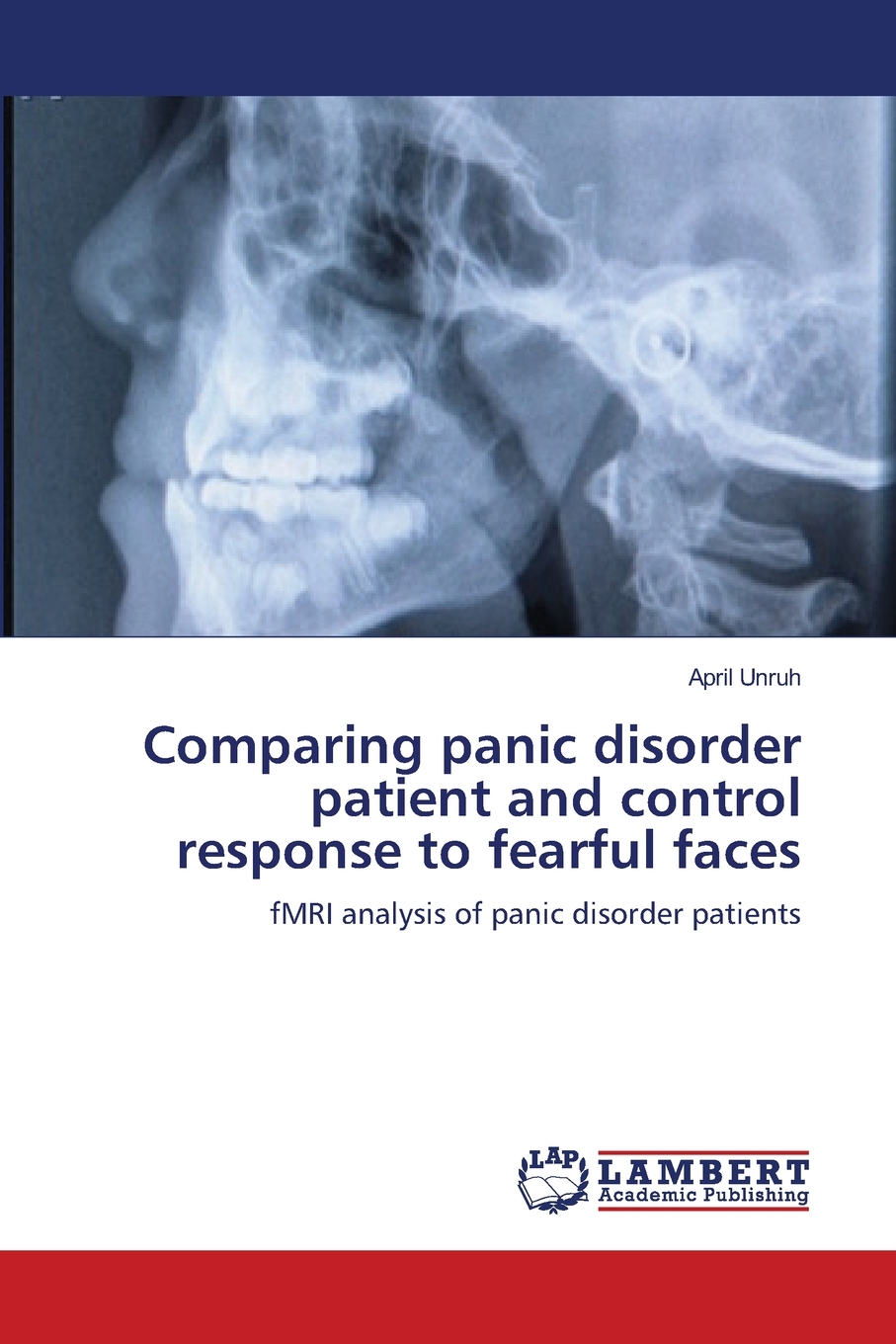 【预售 按需印刷】Comparing panic disorder patient and control response to fearful faces