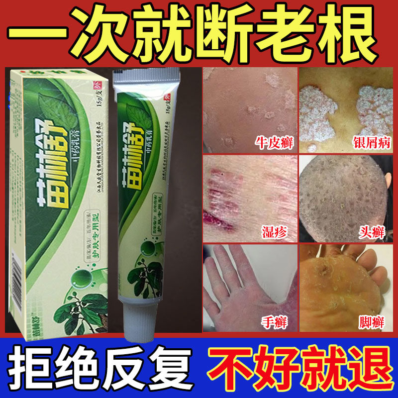 神经性皮炎汗斑止痒膏药手足藓外用癣疥疮特效药膏已售0￥26折后价