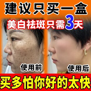 熊果苷烟酰胺美白祛斑霜非医用凝胶面霜保湿去斑祛黄褐斑软膏乳膏