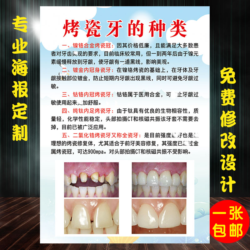 牙科知识挂图口腔宣传图装饰画诊所高档挂画什么是烤瓷牙种类特点在类目 个性定制/设计服务/DIY, 日用/装饰定制, 写真/海报印制中 - 来自Buy2taobao.com提供专业的淘宝代购服务