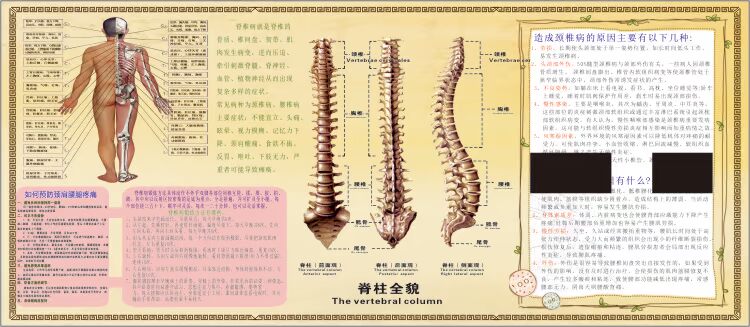 医院人体脊椎骨神经分布病变变大挂图自粘喷绘现代装饰画
